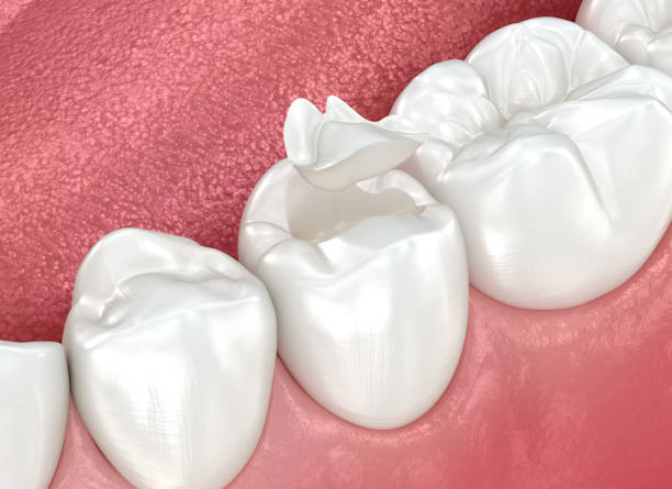 Best Preventive Dentistry  in Central City, IL